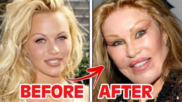 Did Clea Shearer Have Plastic Surgery? Facts To Know About The Reality TV Star